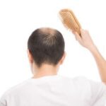 【PR】薄毛に悩んでる方におすすめ！薄毛改善サロンのサービスを徹底解説